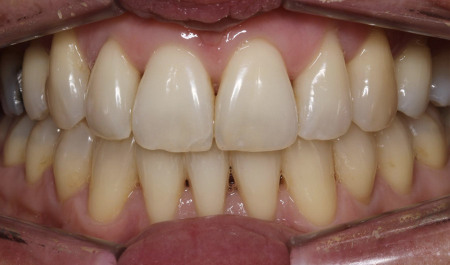 Indications et contre-indications therapeutiques — Orthodontie Rapide